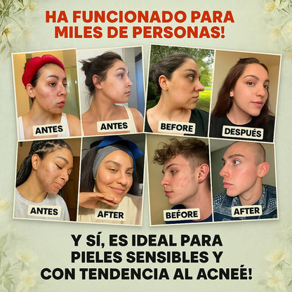 ✨ EVILGOODS™ BÁLSAMO REJUVENECEDOR – REVITALIZA TU PIEL CON SEBO DE RES Y MIEL DE MANUKA 100% NATURAL 🍯